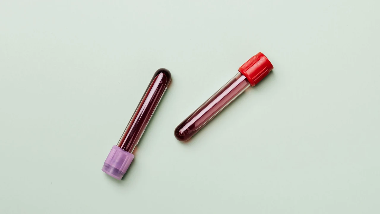 Two labelled blood-sample tubes on a pale background