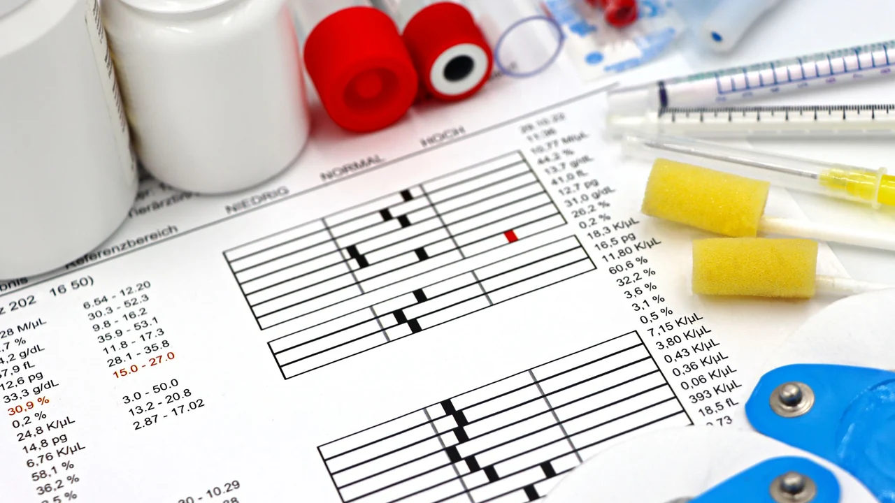 Laboratory sample tubes beside a printed test report.