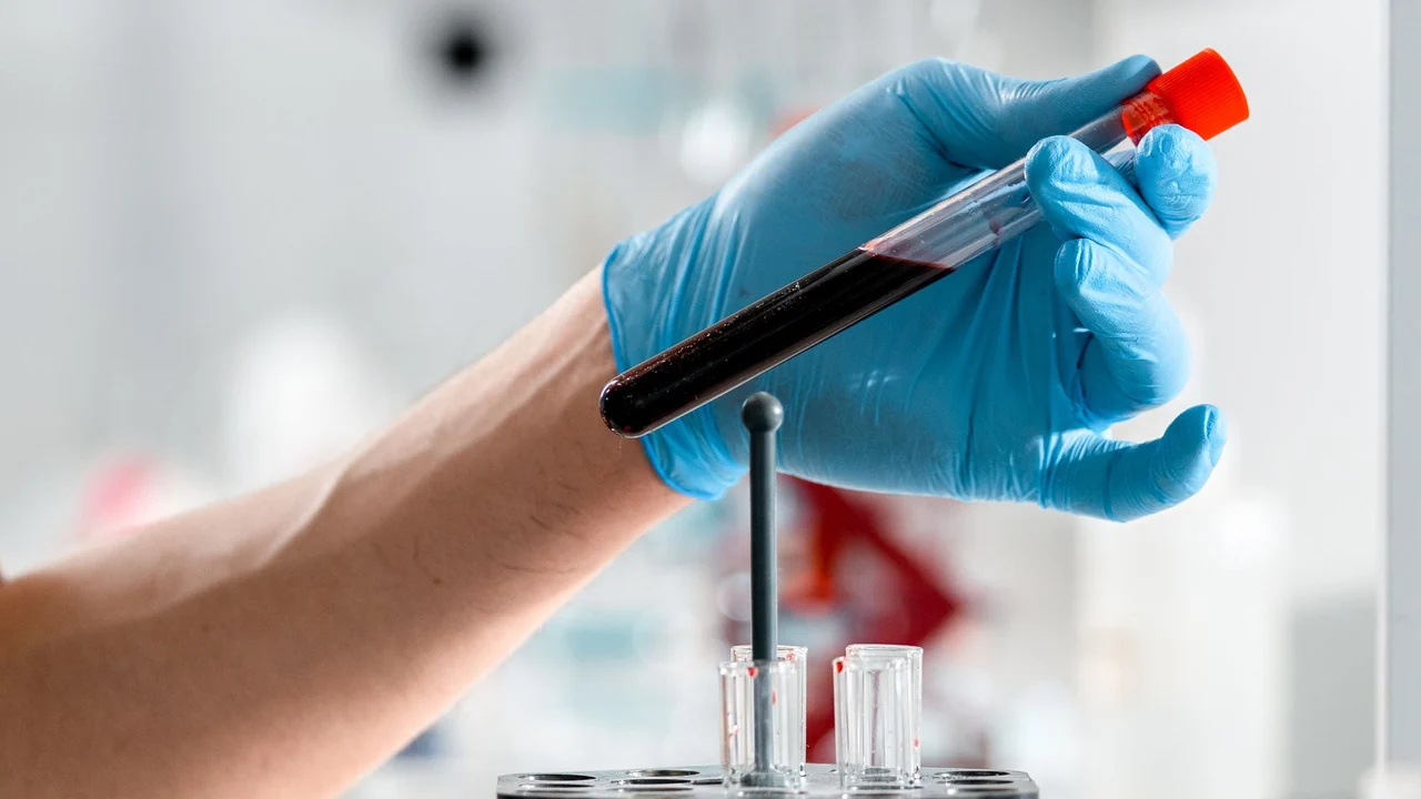 A blood sample being handled in a clinical setting.